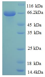 Human NR2C2 / TAK1 Protein (Recombinant 6His, N-terminus)
