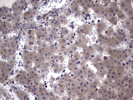 NUMB Antibody (aa1-365, clone OTI1B5)
