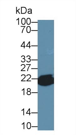 PPIB / Cyclophilin B Antibody (aa34-216, Biotin)