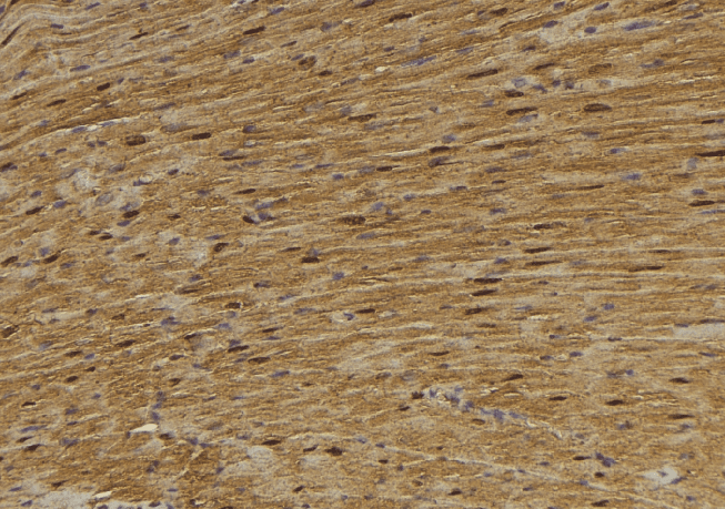 MYH7 Antibody