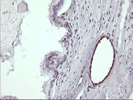 Monoclonal Mouse anti-Human TRIM38 Antibody (clone OTI16D9, IHC, WB)
