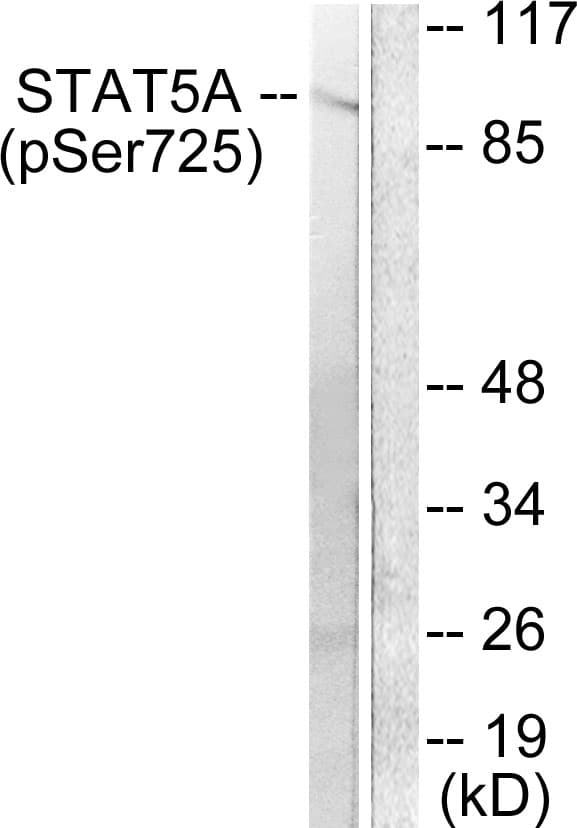 STAT5 A+B Antibody (phospho-Ser725/Ser730)
