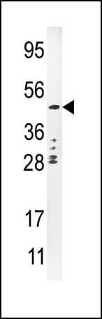Polyclonal Rabbit anti-Human PLAU / Urokinase / uPA Antibody (aa396-426, IHC, IF, WB)