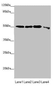Polyclonal Rabbit anti-Human EEF1A2 Antibody (IHC, WB)