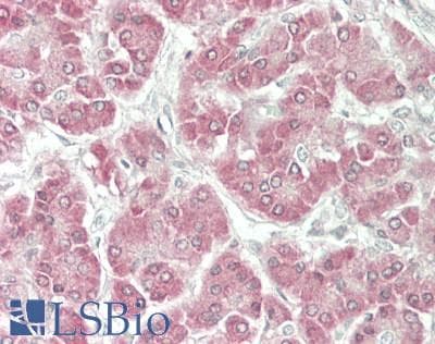 PathPlus™ BCL2L2 / Bcl-w Antibody (aa122-171)