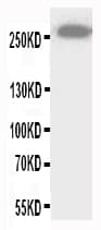 ABCA4 Antibody (aa1892-1903)