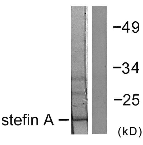 CSTA / Cystatin A Antibody