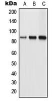 TLK1 Antibody (Internal)