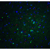 PathPlus™ APOE / Apolipoprotein E Antibody