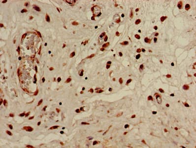 Polyclonal Rabbit anti-Human HIST1H3A Antibody (IHC, IF, WB)
