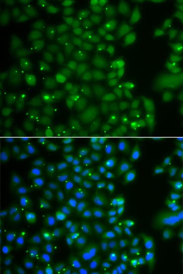 ANXA11 / Annexin XI Antibody