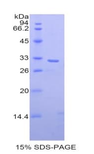 Human PITRM1 / MP1 Protein (Recombinant His)