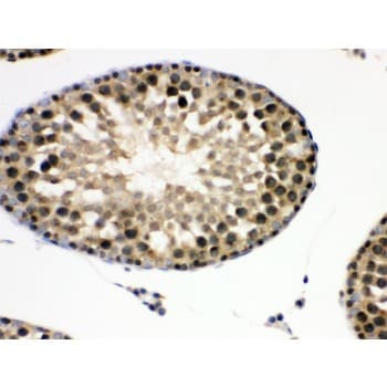 Polyclonal Rabbit anti-Human EIF6 Antibody (aa66-210, IHC, WB)
