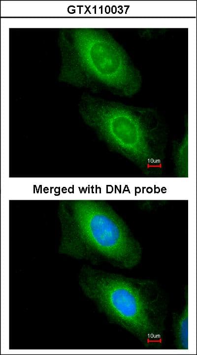 Polyclonal Rabbit anti-Human MLYCD / MCD Antibody (aa90-304, IHC, WB)