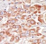 SRPK3 / MSSK1 Antibody (aa285-315)