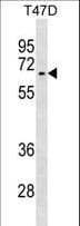 ALK2 / ACVR1 Antibody (aa85-123)