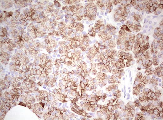 Basic Cytokeratin AE3 Antibody (clone AE3)