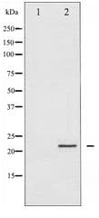PPP1R14A / CPI-17 Antibody