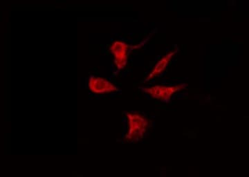 Polyclonal Rabbit anti-Human PGRMC2 Antibody (IF, WB)