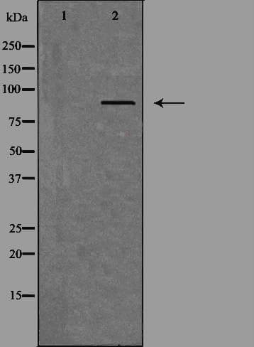TLK1 Antibody