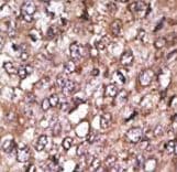ATG4A Antibody (aa1-30)
