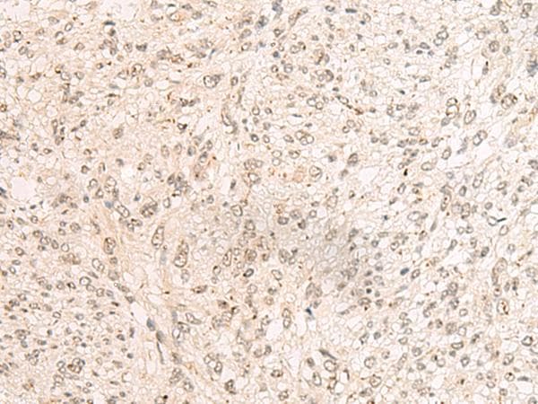 PD2 / PAF1 Antibody