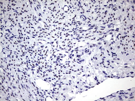 ZEB1 / AREB6 Antibody (aa1-350, clone OTI8E2)