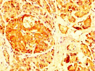 RAB26 Antibody