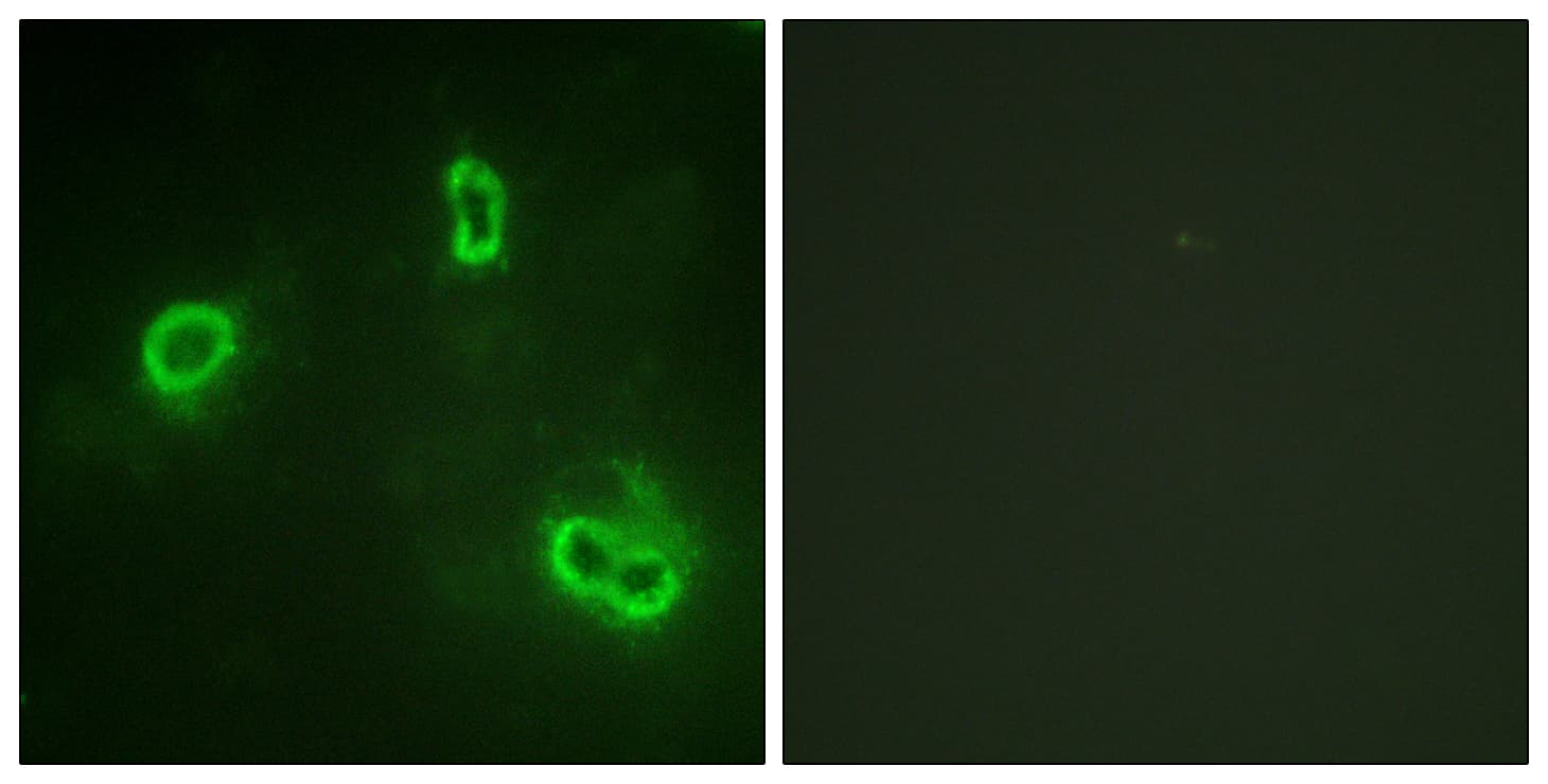 Polyclonal Rabbit anti-Human RPS6KA1 / RSK1 Antibody (aa539-588, IHC, IF, WB)