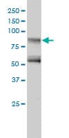 IHC-plus™ GIT2 Antibody (clone 3B5-B9)