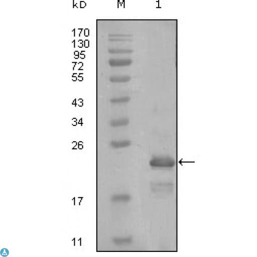 HAND1 Antibody
