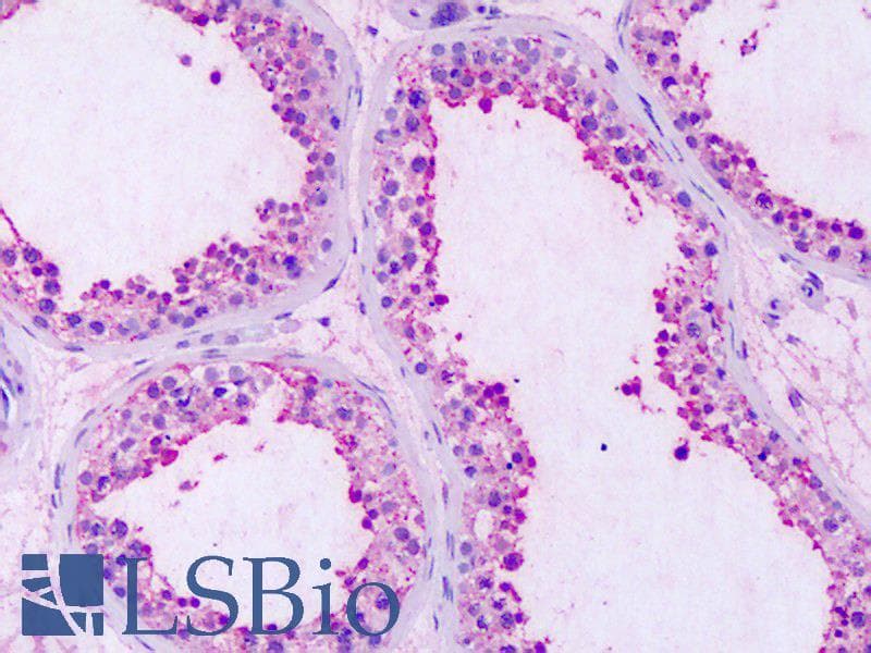 IHC-plus™ GPRC5A / RAI3 Antibody (Extracellular Domain)