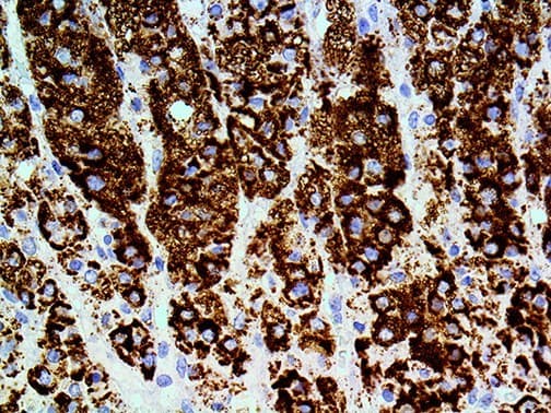 PLIN2 / ADFP / Adipophilin Antibody