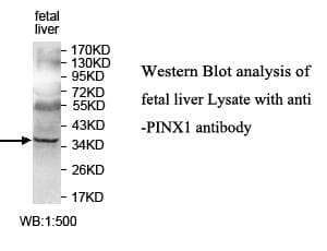 Polyclonal Rabbit anti-Human PINX1 Antibody (aa21-281, IHC, WB)