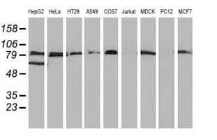 VCAM1 / CD106 Antibody (clone OTI3H10, Carrier-free)
