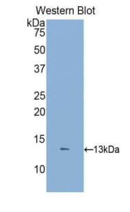 DKK2 Antibody (aa159-258, FITC)