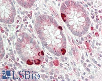 IHC-plus™ Polyclonal Rabbit anti-Human DFNA5 Antibody (aa231-270, IHC, WB)