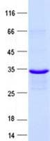 Human NAT2 Protein (Recombinant His, N-Terminal)