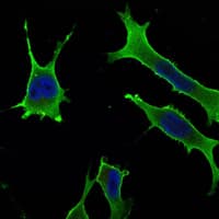 Monoclonal Mouse anti-Human RAB10 Antibody (clone 400, IF, WB)