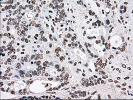 Monoclonal Mouse anti-Human TYRO3 Antibody (clone OTI2G2, IHC, WB)
