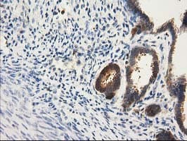 CAT / Catalase Antibody (clone 1B6, Carrier-free)