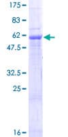 Human ZDHHC12 Protein (Recombinant GST)