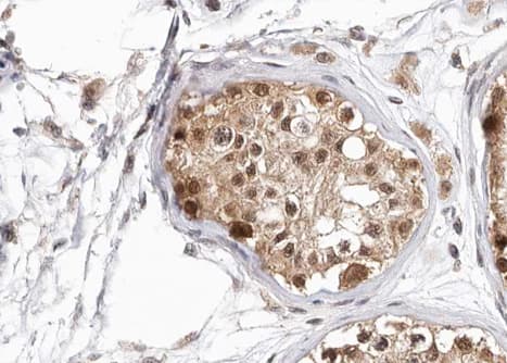 Polyclonal Rabbit anti-Human HDAC6 Antibody (phospho-Ser22, IHC, IF, WB)