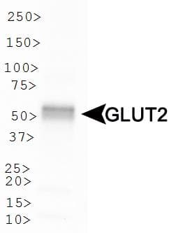 PathPlus™ Polyclonal Rabbit anti-Human SLC2A2 / GLUT2 Antibody (aa50-150, IHC, IF, WB)
