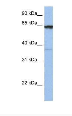 POPDC2 Antibody (aa218-267, FITC)