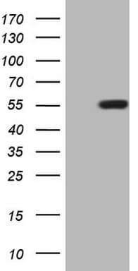 ZIC3 Antibody (aa242-467, clone OTI6F7, Carrier-free)
