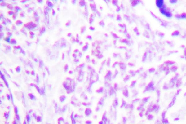 PPARG / PPAR Gamma Antibody (Ile106)