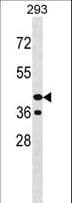 PNCK / CaMK1b Antibody (aa295-323)