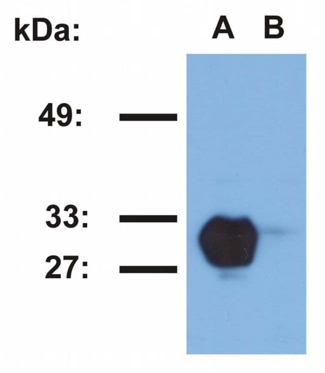 Monoclonal Mouse anti-Human HLA-DR1 Antibody (clone MEM-267, WB)