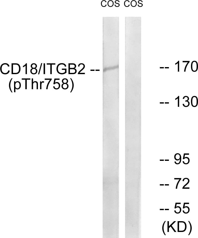 ITGB2 / CD18 Antibody (phospho-Thr758)